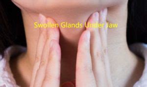 Treatment for Swollen Under Jaw Lymph Nodes
