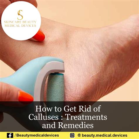 Treatment and Prevention of Calluses