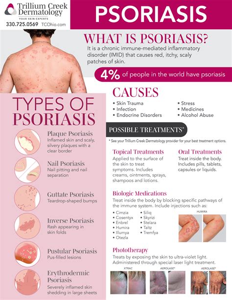 Treatment of Psoriasis