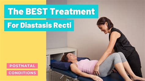 treatment options for diastasis recti