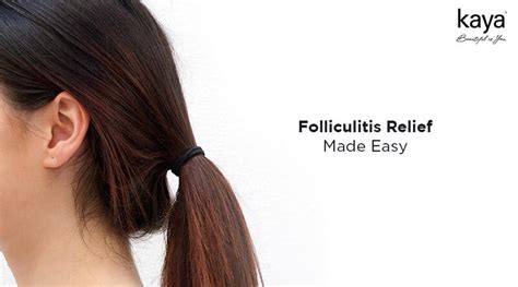 treatment options for folliculitis