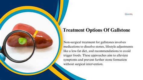 treatment options for gallstones