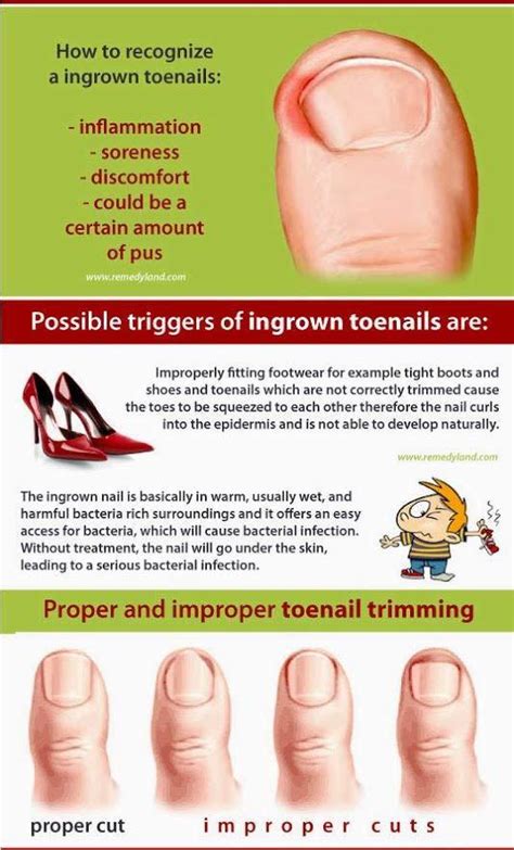 Treatment Options for Ingrown Nails