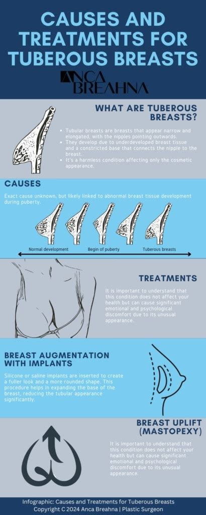 treatment options for nipple pain
