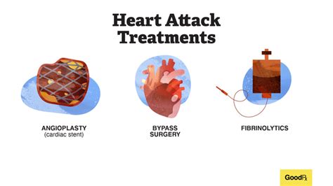 Treatment Options for Reflux Heart Attack