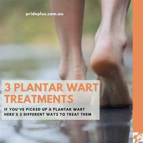 Treatment Options for Plantar Warts