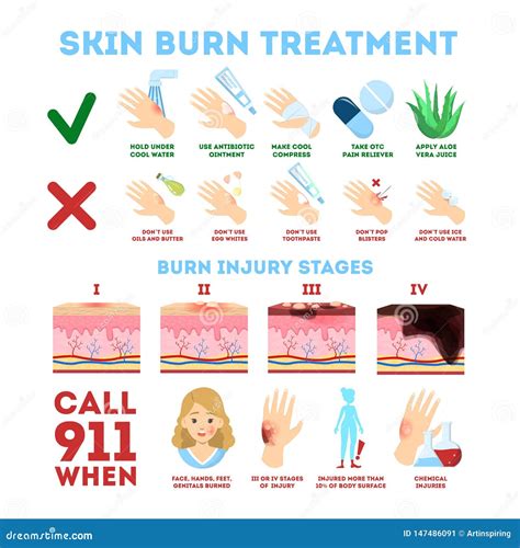 Treatments for Burned Skin