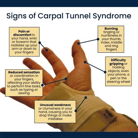 Treatments for Carpal Tunnel Syndrome