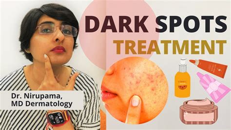 Treatments for Dark Spots