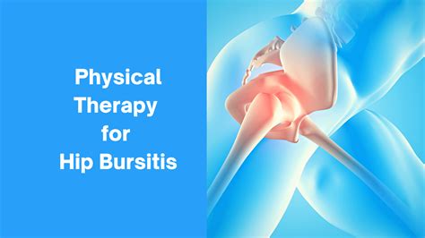 Treatments for Hip Bursitis