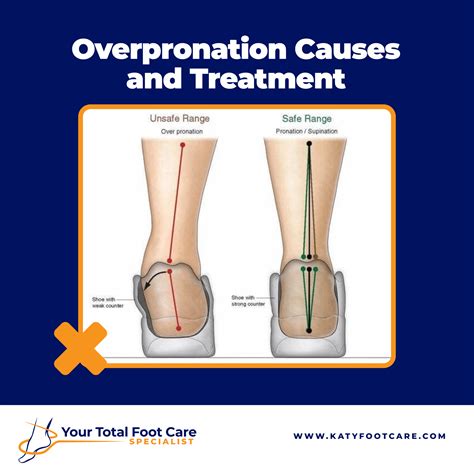 Treatments for Pronation Foot