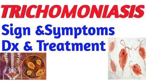 Trichomoniasis Complications