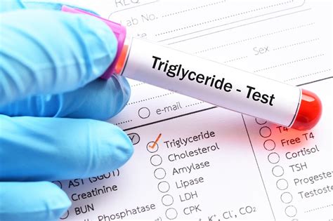 Triglycerides Blood Test Results
