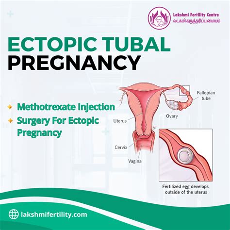 Tubal Ectopic Pregnancy and Future Pregnancies