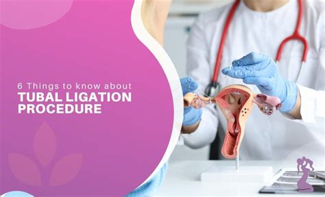 Tubal Ligation Procedure Overview