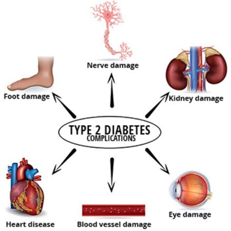 Type 2 Diabetes Complications