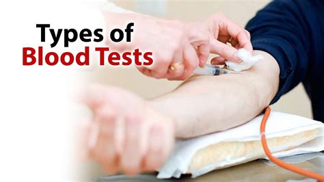 Types of Blood Tests