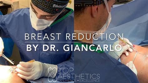 types of breast reduction and lift techniques