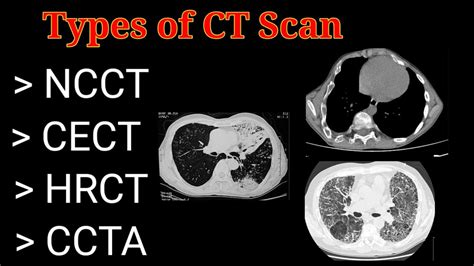 types of head ct scans