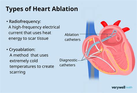 types of heart ablation