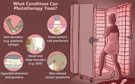 Types of Light Used in Eczema Light Therapy