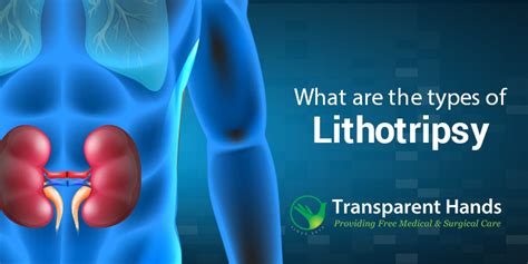 types of lithotripsy