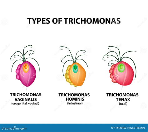 Types of Trich