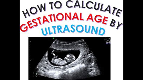 ultrasound due date