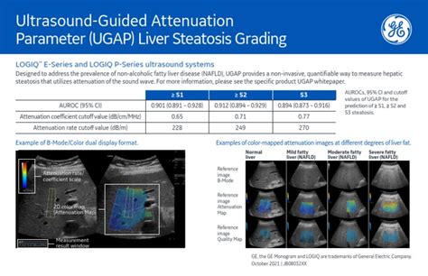 Ultrasound Method