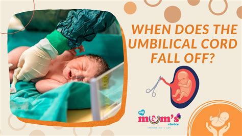 Umbilical Cord Falling Off