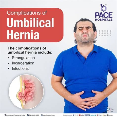 Umbilical Hernia Complications