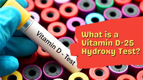 Understanding 25-Hydroxyvitamin D Test Results