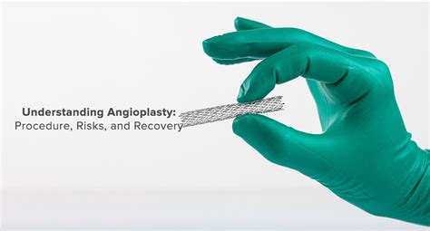 Understanding Angioplasty