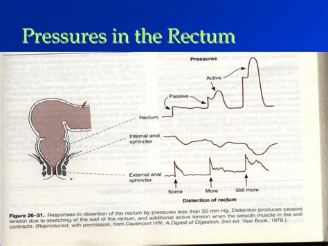 Understanding Anus Pressure