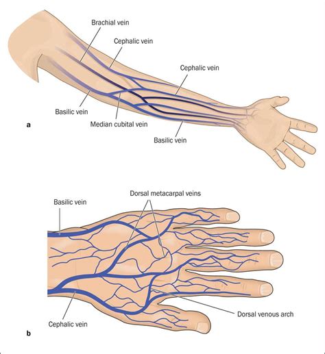 Understanding Arm Pain