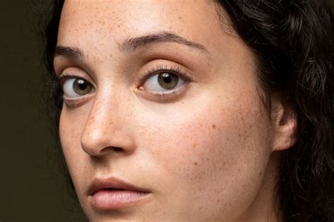 Understanding Dark Spots