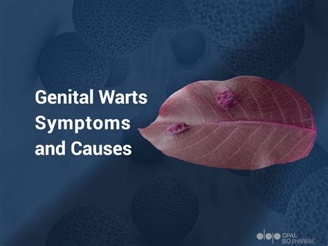 Understanding Genital Warts