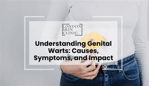 Understanding Genital Warts