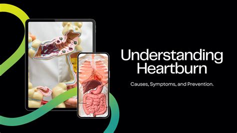 Understanding Heartburn