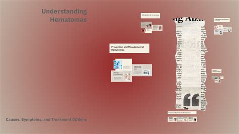 Understanding Hematomas