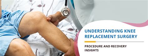 Understanding Knee Transplant Surgery