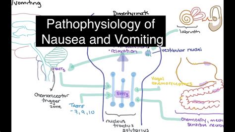 Understanding Nausea
