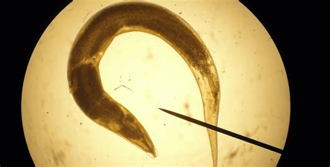 Understanding Pinworm Infections