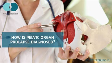 Understanding Prolapse
