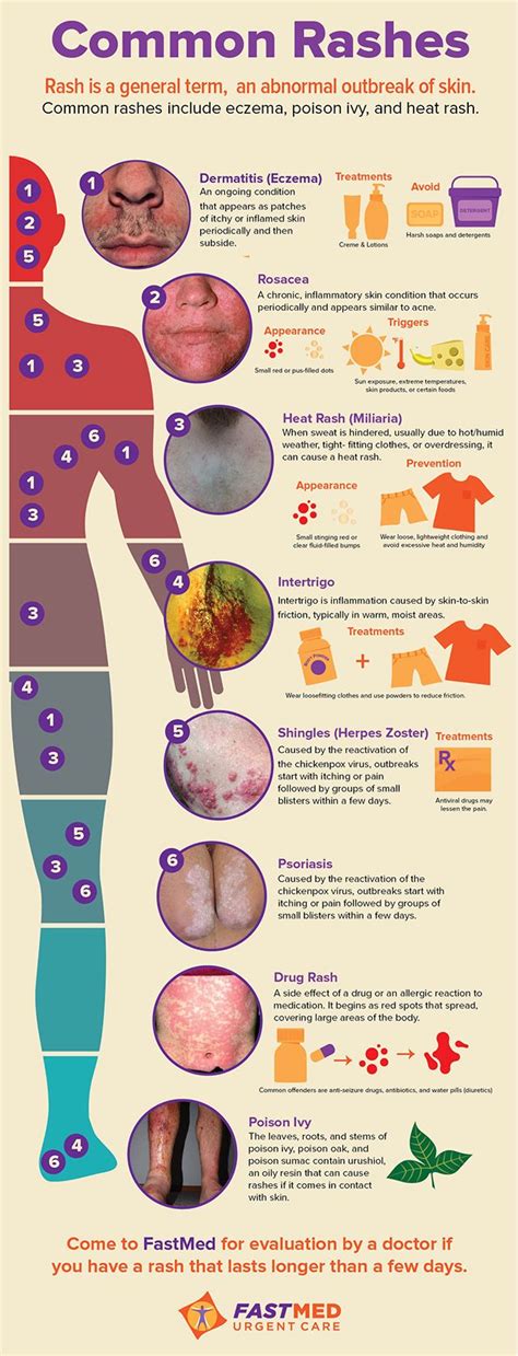 Understanding Rashes