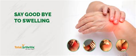 Understanding Swelling