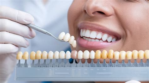 Understanding Teeth Whitening