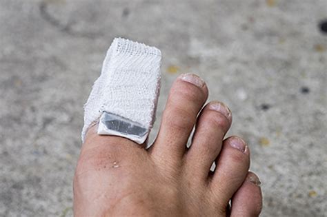 Understanding Toe Break Symptoms
