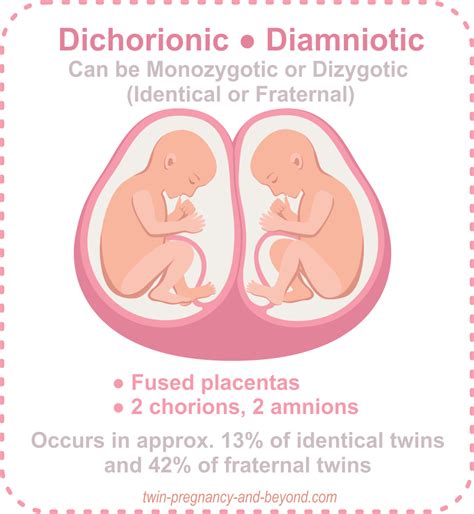 Understanding Twin Pregnancy