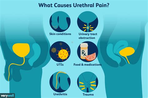 Understanding Urethra Pain